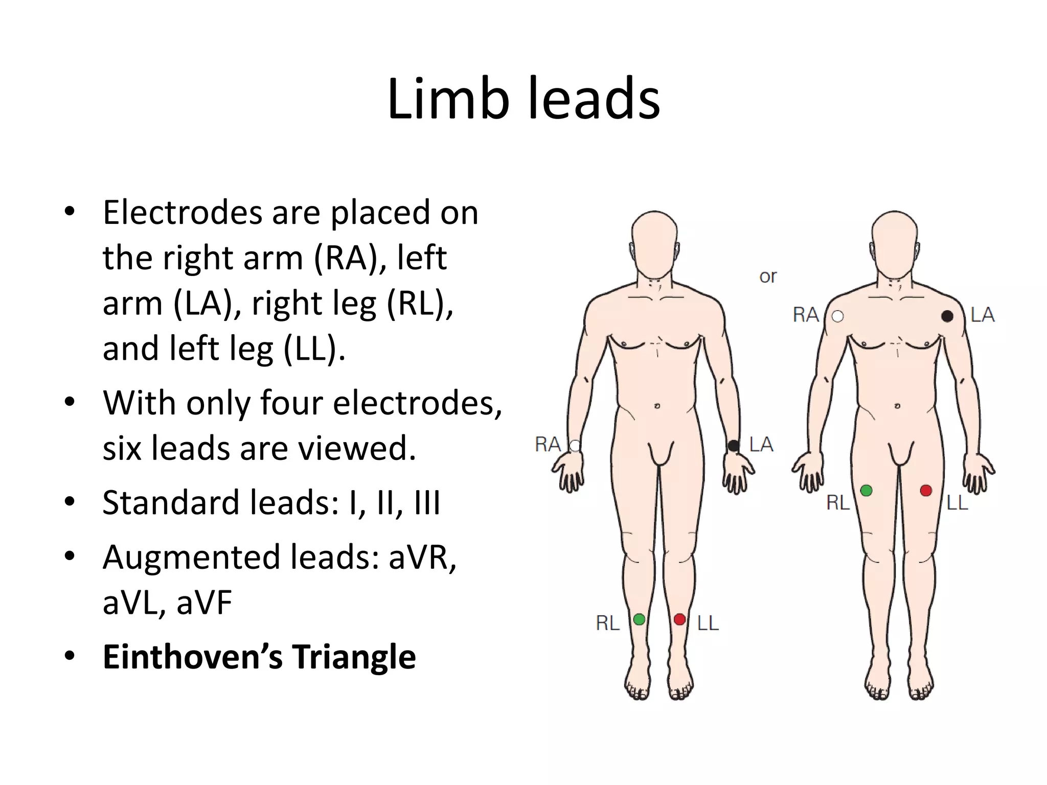 Limb leads
• Electrodes are placed on
the right arm (RA), left
arm (LA), right leg (RL),
and left leg (LL).
• With only four electrodes,
six leads are viewed.
• Standard leads: I, II, III
• Augmented leads: aVR,
aVL, aVF
• Einthoven’s Triangle
 