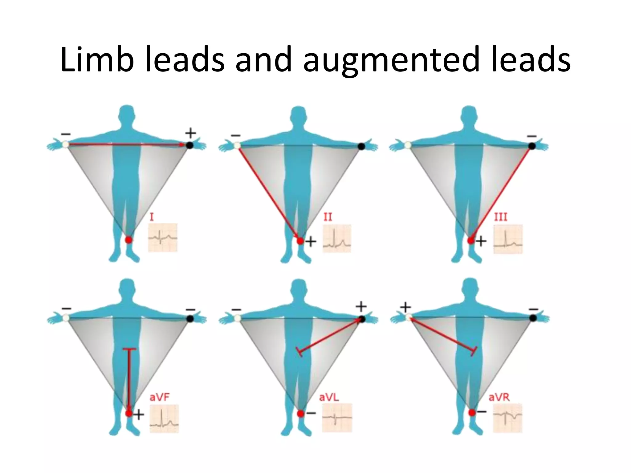 Limb leads and augmented leads
 