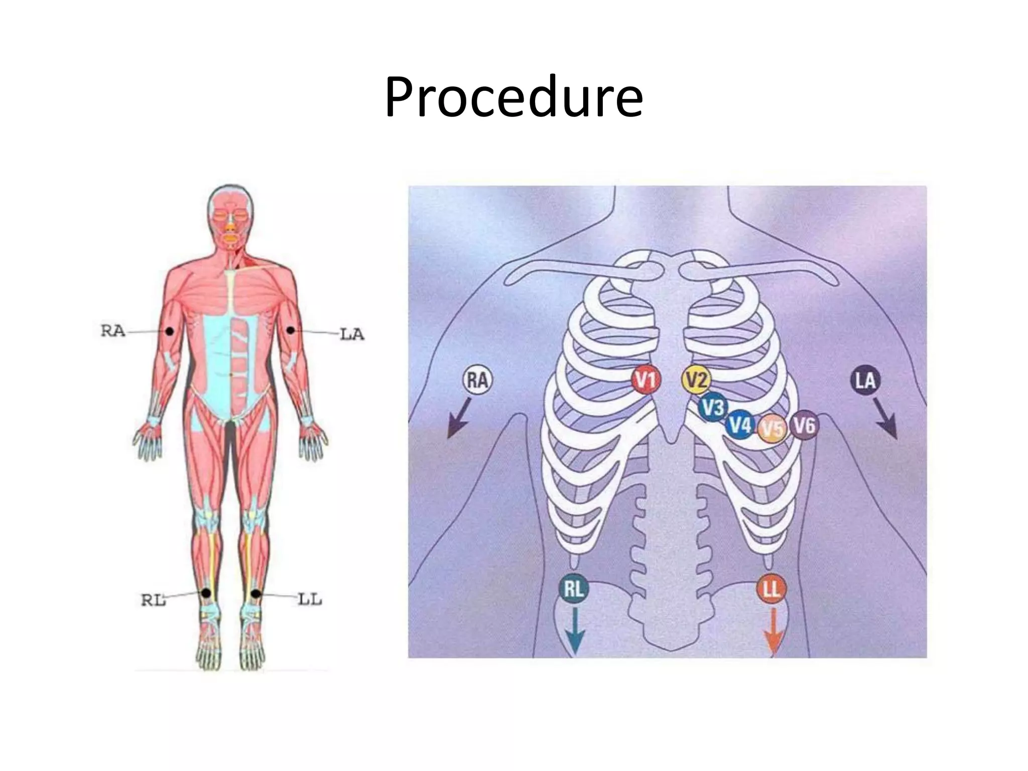 Procedure
 