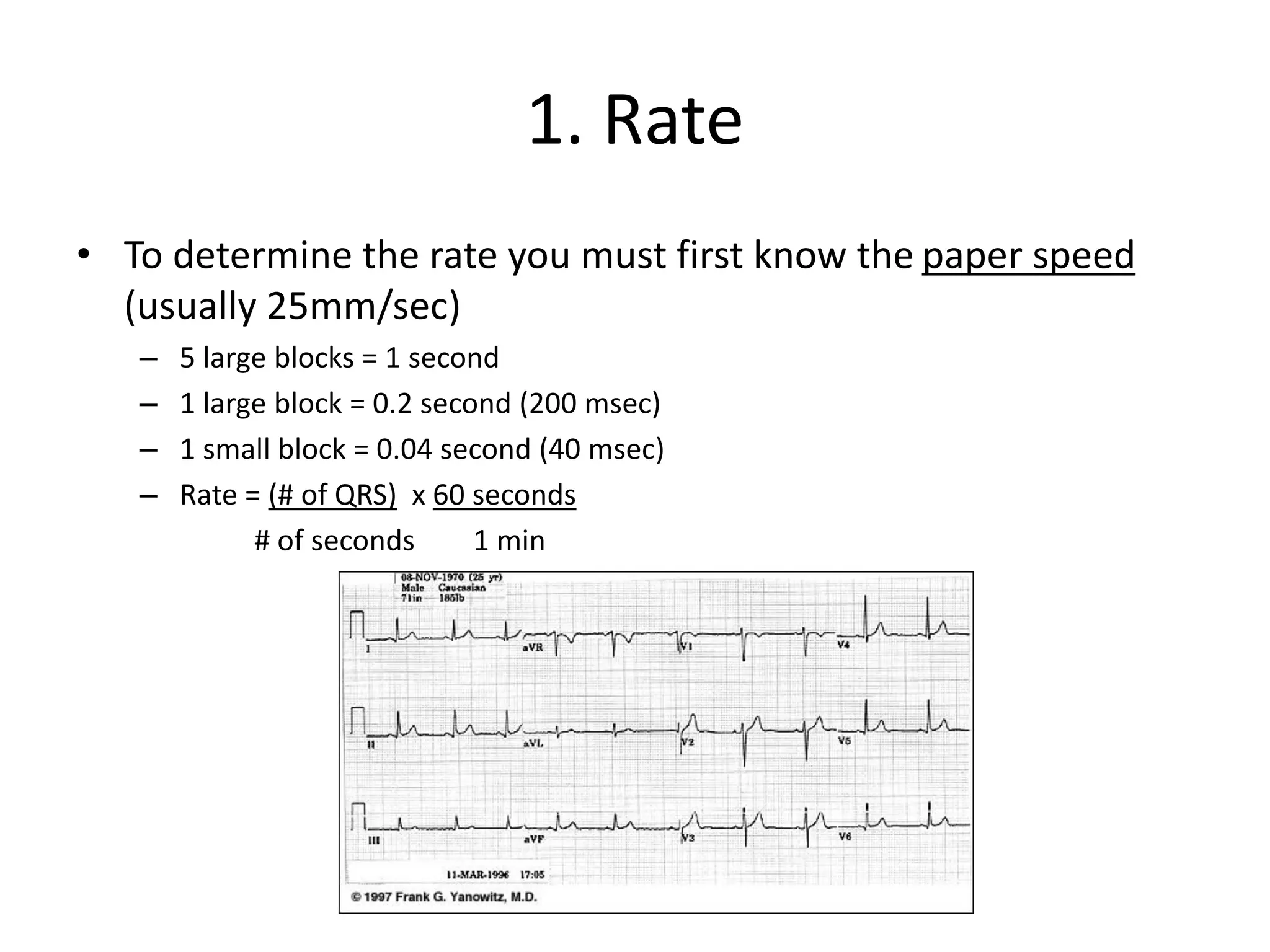 1. Rate
• To determine the rate you must first know the paper speed
(usually 25mm/sec)
– 5 large blocks = 1 second
– 1 large block = 0.2 second (200 msec)
– 1 small block = 0.04 second (40 msec)
– Rate = (# of QRS) x 60 seconds
# of seconds 1 min
 