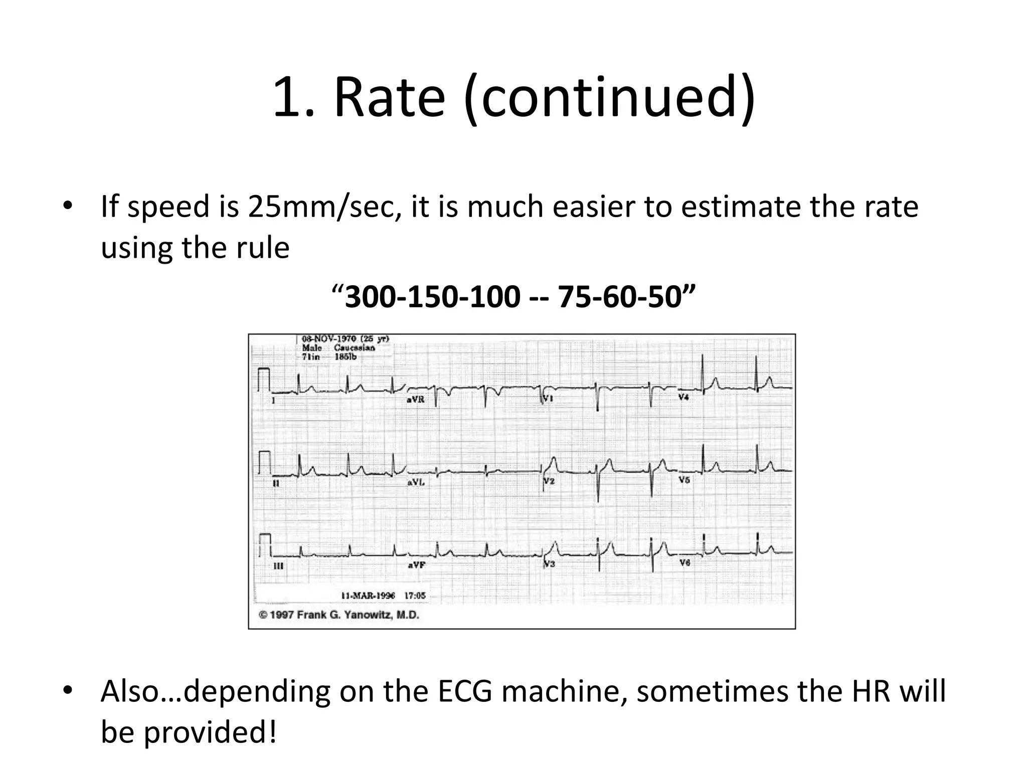 1. Rate (continued)
• If speed is 25mm/sec, it is much easier to estimate the rate
using the rule
“300-150-100 -- 75-60-50”
• Also…depending on the ECG machine, sometimes the HR will
be provided!
 