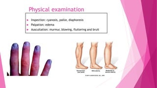 Physical examination
 Inspection: cyanosis, pallor, diaphoresis
 Palpation: edema
 Auscultation: murmur, blowing, fluttering and bruit
 