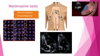 Noninvasive tests
 Electrocardiogram
 Echocardiography
 