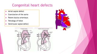 Congenital heart defects
 Atrial septal defect
 Coarctacion of the aorta
 Patent ductus arteriosus
 Tetralogy of fallot
 Ventricular septal defect
 