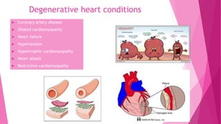 Degenerative heart conditions
 Coronary artery disease
 Dilated cardiomyopathy
 Heart failure
 Hypertension
 Hypertrophic cardiomyopathy
 Heart attack
 Restrictive cardiomyopathy
 