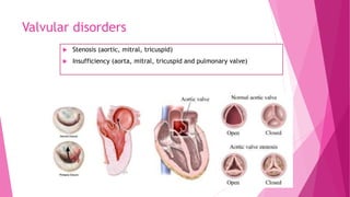 Valvular disorders
 Stenosis (aortic, mitral, tricuspid)
 Insufficiency (aorta, mitral, tricuspid and pulmonary valve)
 