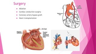 Surgery
 Ablation
 Cardiac conduction surgery
 Coronary artery bypass graft
 Heart transplantation
 