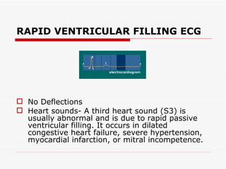 RAPID VENTRICULAR FILLING ECG No Deflections  Heart sounds- A third heart sound (S3) is usually abnormal and is due to rapid passive ventricular filling. It occurs in dilated congestive heart failure, severe hypertension, myocardial infarction, or mitral incompetence. 