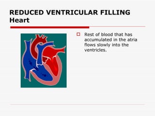 REDUCED VENTRICULAR FILLING Heart Rest of blood that has accumulated in the atria flows slowly into the ventricles. 