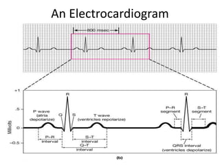 An Electrocardiogram
 