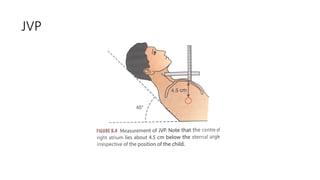 cardiovascular system examination-1.pptx