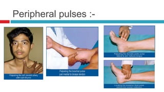 Cardiovascular system examination | PPTX