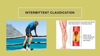 Cardiovascular system history taking | PPTX