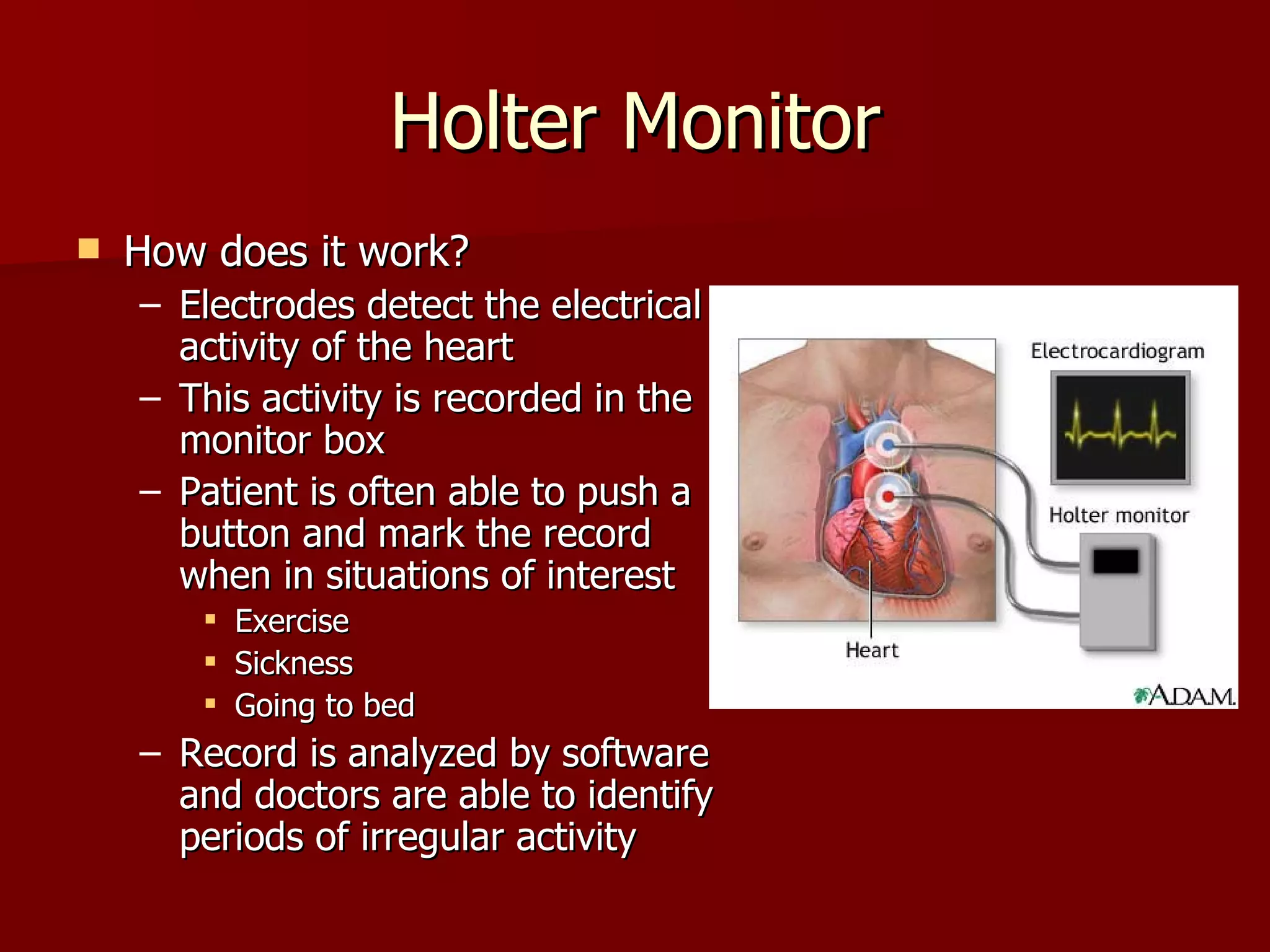 Holter Monitor How does it work? Electrodes detect the electrical activity of the heart This activity is recorded in the monitor box Patient is often able to push a button and mark the record when in situations of interest Exercise Sickness Going to bed Record is analyzed by software and doctors are able to identify periods of irregular activity 