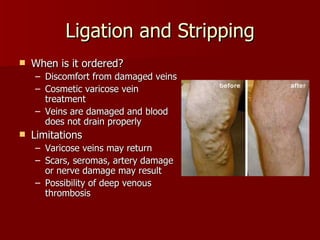 Cardiovascular system procedures | PPT
