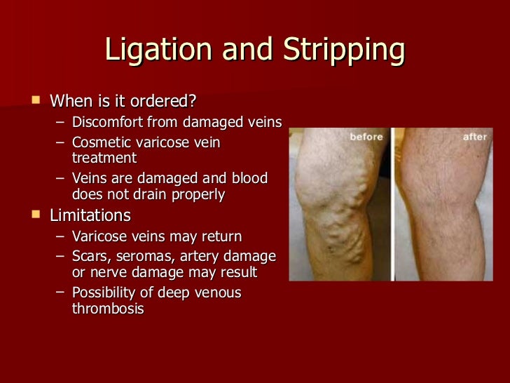 Cardiovascular system procedures