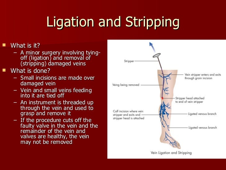 Cardiovascular system procedures