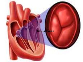 Tricuspid Valve
 