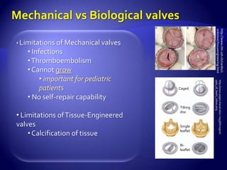 ardiotext/tissueengineering.html
                                                      http://www.chir.uzh.ch/cardio/c
• Limitations of Mechanical valves
   • Infections
   • Thromboembolism
   • Cannot grow
        • important for pediatric




                                               ypes_of_heart_valves.png
                                               http://www.pages.drexel.edu/~nag38/Images/t
        patients                     Caged

   • No self-repair capability
                                     Tilting
                                     disc
• Limitations of Tissue-Engineered
valves                               Single

    • Calcification of tissue        leaflet


                                     Bi-
                                     leaflet
 