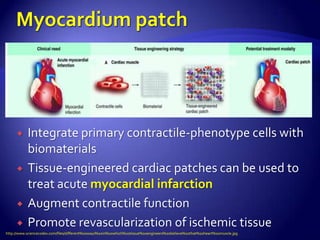     x

          Integrate primary contractile-phenotype cells with
           biomaterials
          Tissue-engineered cardiac patches can be used to
           treat acute myocardial infarction
          Augment contractile function
          Promote revascularization of ischemic tissue
http://www.sciencecodex.com/files/different%20ways%20in%20which%20tissue%20engineers%20believe%20that%20heart%20muscle.jpg
 