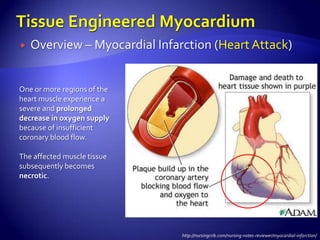    Overview – Myocardial Infarction (Heart Attack)


One or more regions of the
heart muscle experience a
severe and prolonged
decrease in oxygen supply
because of insufficient
coronary blood flow.

The affected muscle tissue
subsequently becomes
necrotic.




                               http://nursingcrib.com/nursing-notes-reviewer/myocardial-infarction/
 