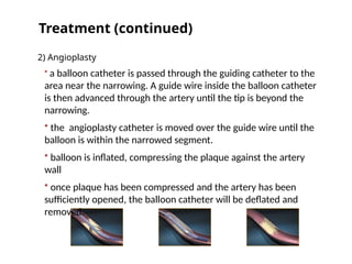 Compressing A Balloon CARDIOVASULAR DISEASE,CARDIOVASULAR DISEASE,CARDIOVASULAR DISEASE ...