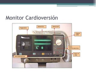 Cardioversion 100j Cardioversión | PPTX