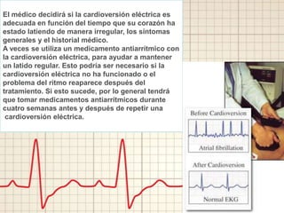 El médico decidirá si la cardioversión eléctrica es
adecuada en función del tiempo que su corazón ha
estado latiendo de manera irregular, los síntomas
generales y el historial médico.
A veces se utiliza un medicamento antiarrítmico con
la cardioversión eléctrica, para ayudar a mantener
un latido regular. Esto podría ser necesario si la
cardioversión eléctrica no ha funcionado o el
problema del ritmo reaparece después del
tratamiento. Si esto sucede, por lo general tendrá
que tomar medicamentos antiarrítmicos durante
cuatro semanas antes y después de repetir una
cardioversión eléctrica.
 