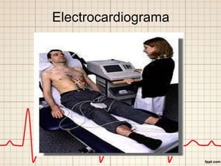 Electrocardiograma
 
