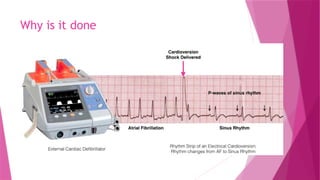 Cardioversion Why CARDIOVERSION.pptx medical surgical nursing. | PPTX
