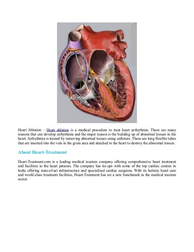 Cardioversion,Heart Ablation,Statins