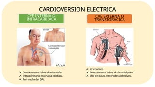 CARDIOVERSION Y DESFIBRILACION para ser usado en personal de salud 2024 ...
