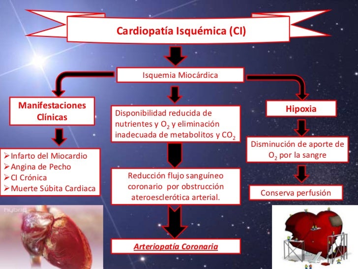 A Fisiopatologia Da Cardiopatia Isquemica Envolve Especificamente Dois Processos