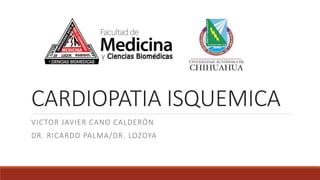 CARDIOPATIA ISQUEMICA
VICTOR JAVIER CANO CALDERÓN
DR. RICARDO PALMA/DR. LOZOYA
 