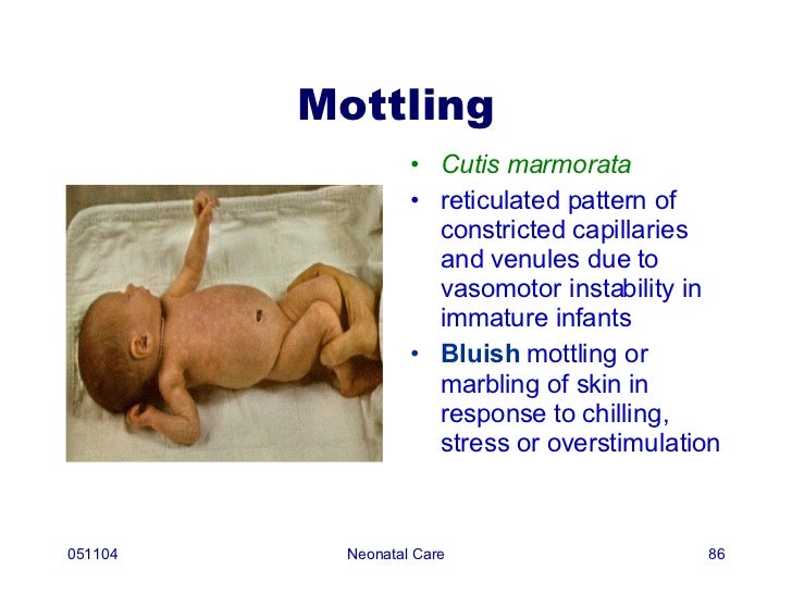Care Of The Newborn Care Of The Newborn