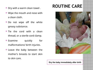 ROUTINE CARE
 Dry with a warm clean towel .
 Wipe the mouth and nose with
a clean cloth.
 Do not wipe off the white
greasy substance.
 Tie the cord with a clean
thread, or a sterile cord clamp.
 Examine quickly for
malformations/ birth injuries.
 Leave the baby between the
mother’s breasts to start skin
to skin care.
Dry the baby immediately after birth
 