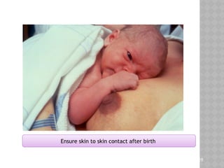 Teaching Aids: ENC
NC-
Ensure skin to skin contact after birth
28
 
