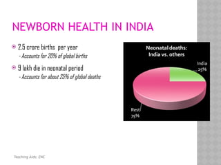 NEWBORN HEALTH IN INDIA
 2.5 crore births per year
- Accounts for 20% of global births
 9 lakh die in neonatal period
- Accounts for about 25% of global deaths
Teaching Aids: ENC
 