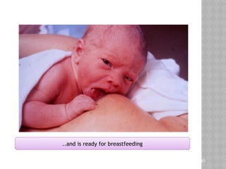 Teaching Aids: ENC
NC-
..and is ready for breastfeeding
30
 