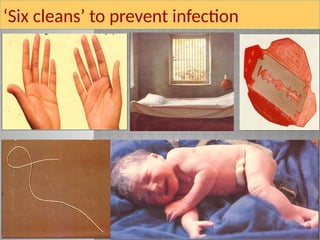 ‘Six cleans’ to prevent infection
 