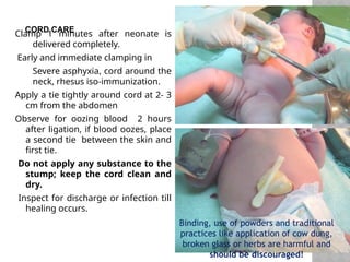 CORD CARE
Clamp 1 minutes after neonate is
delivered completely.
Early and immediate clamping in
- Severe asphyxia, cord around the
neck, rhesus iso-immunization.
Apply a tie tightly around cord at 2- 3
cm from the abdomen
Observe for oozing blood 2 hours
after ligation, if blood oozes, place
a second tie between the skin and
first tie.
Do not apply any substance to the
stump; keep the cord clean and
dry.
Inspect for discharge or infection till
healing occurs.
Binding, use of powders and traditional
practices like application of cow dung,
broken glass or herbs are harmful and
should be discouraged!
 