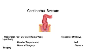 Carcinoma Rectum
Moderator-Prof Dr. Vijay Kumar Goel Presenter-Dr Divya
Upadhyay
Head of Department Jr-2
General Surgery General
Surgery
 