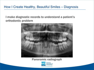 How I Create Healthy, Beautiful Smiles – Diagnosis
I make diagnostic records to understand a patient’s
orthodontic problem
Panoramic radiograph
 