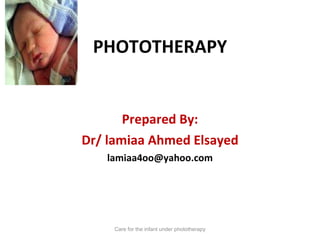 PHOTOTHERAPY ,[object Object],[object Object],[object Object],Care for the infant under phototherapy 