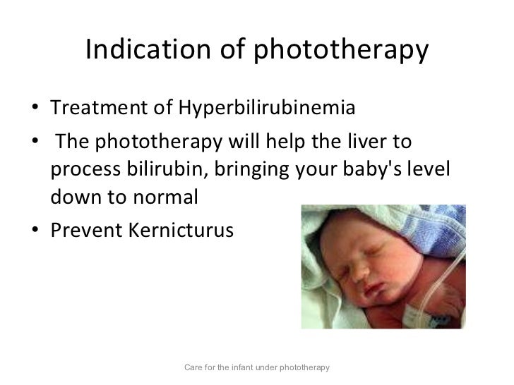 Care for the child uderphototherapy