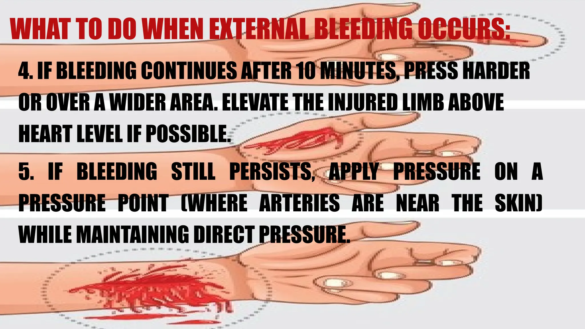 4. IF BLEEDING CONTINUES AFTER 10 MINUTES, PRESS HARDER
OR OVER A WIDER AREA. ELEVATE THE INJURED LIMB ABOVE
HEART LEVEL IF POSSIBLE.
5. IF BLEEDING STILL PERSISTS, APPLY PRESSURE ON A
PRESSURE POINT (WHERE ARTERIES ARE NEAR THE SKIN)
WHILE MAINTAINING DIRECT PRESSURE.
WHAT TO DO WHEN EXTERNAL BLEEDING OCCURS:
 