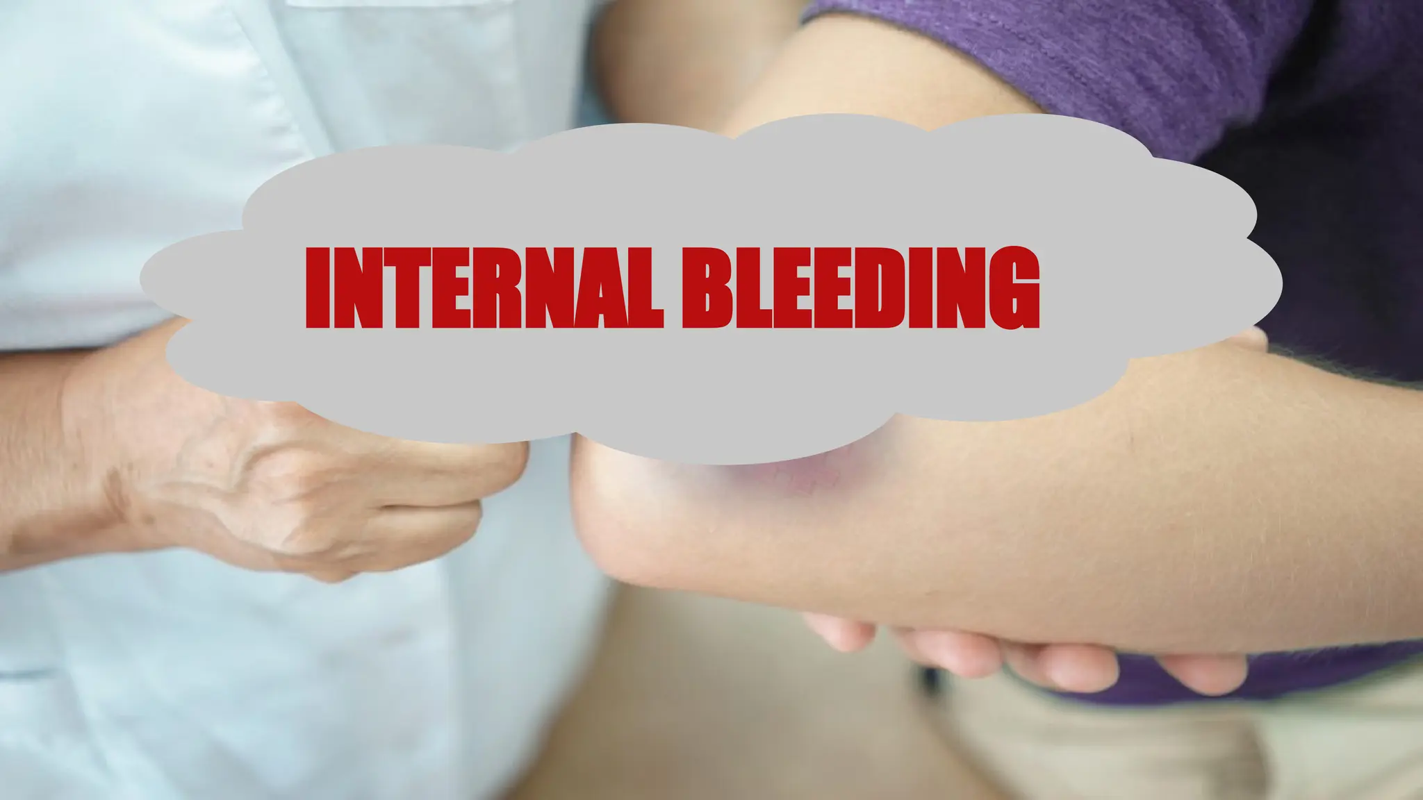 INTERNAL BLEEDING
 
