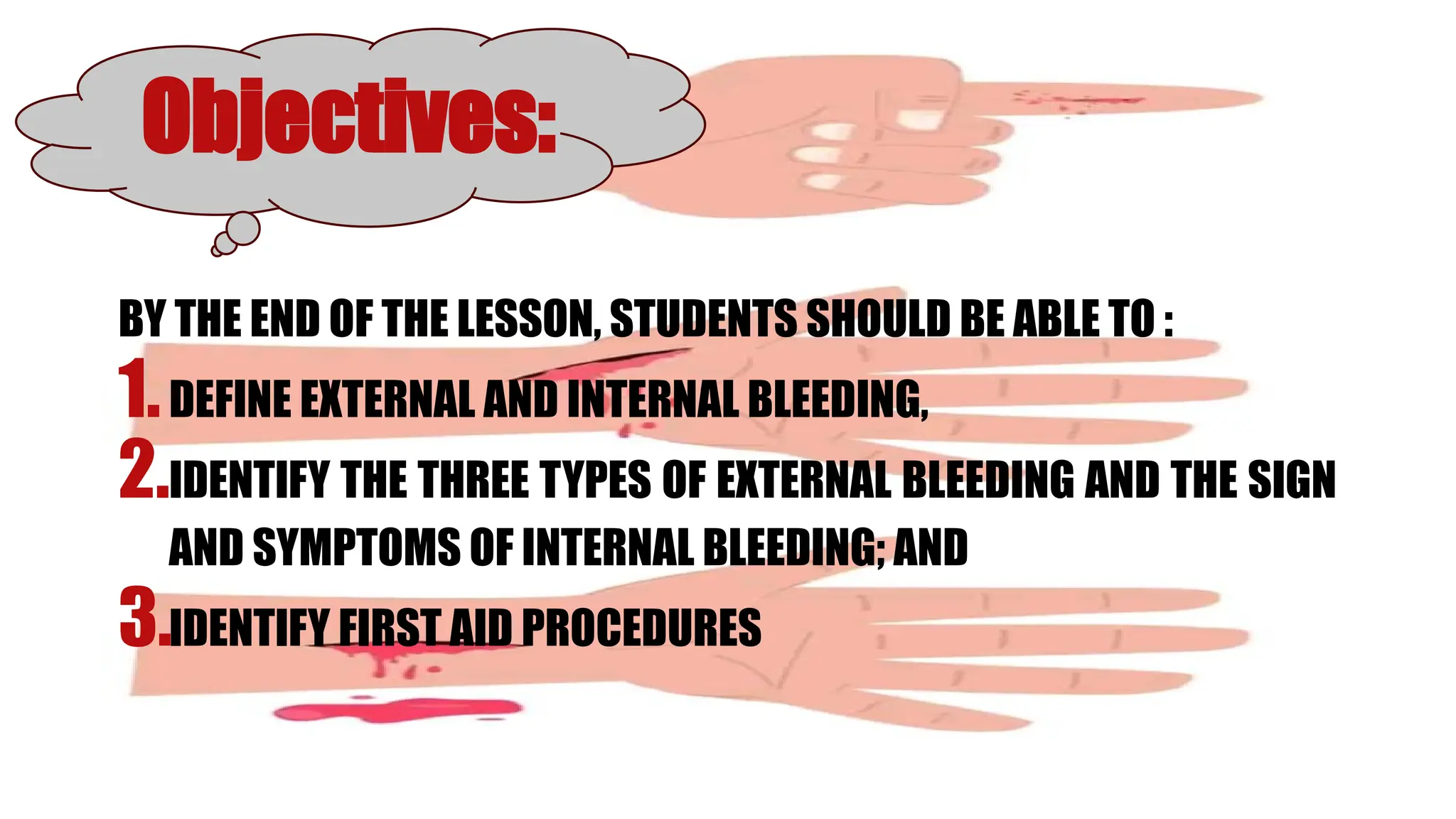 BY THE END OF THE LESSON, STUDENTS SHOULD BE ABLE TO :
1.DEFINE EXTERNAL AND INTERNAL BLEEDING,
2.IDENTIFY THE THREE TYPES OF EXTERNAL BLEEDING AND THE SIGN
AND SYMPTOMS OF INTERNAL BLEEDING; AND
3.IDENTIFY FIRST AID PROCEDURES
Objectives:
 