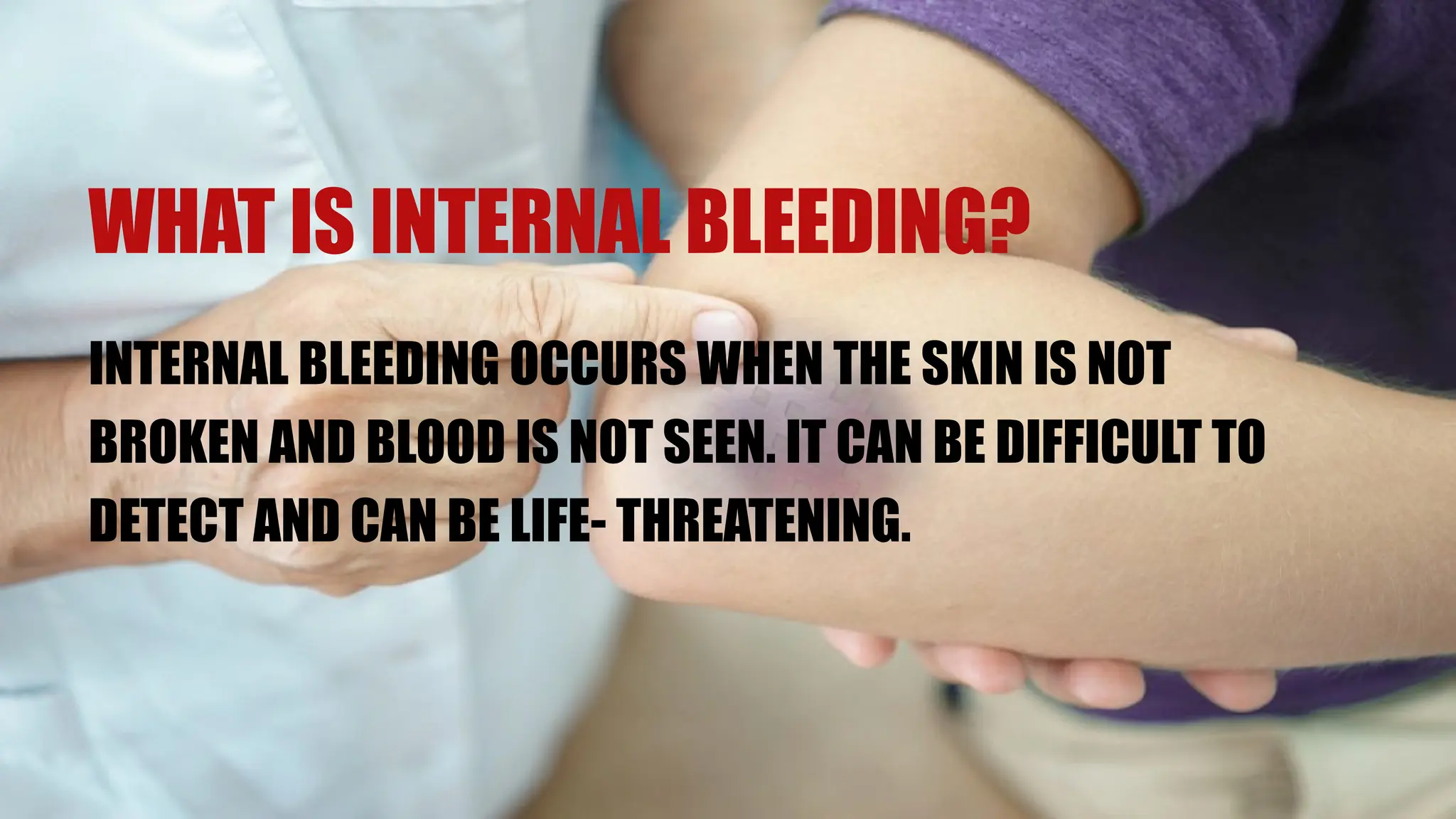 WHAT IS INTERNAL BLEEDING?
INTERNAL BLEEDING OCCURS WHEN THE SKIN IS NOT
BROKEN AND BLOOD IS NOT SEEN. IT CAN BE DIFFICULT TO
DETECT AND CAN BE LIFE- THREATENING.
 
