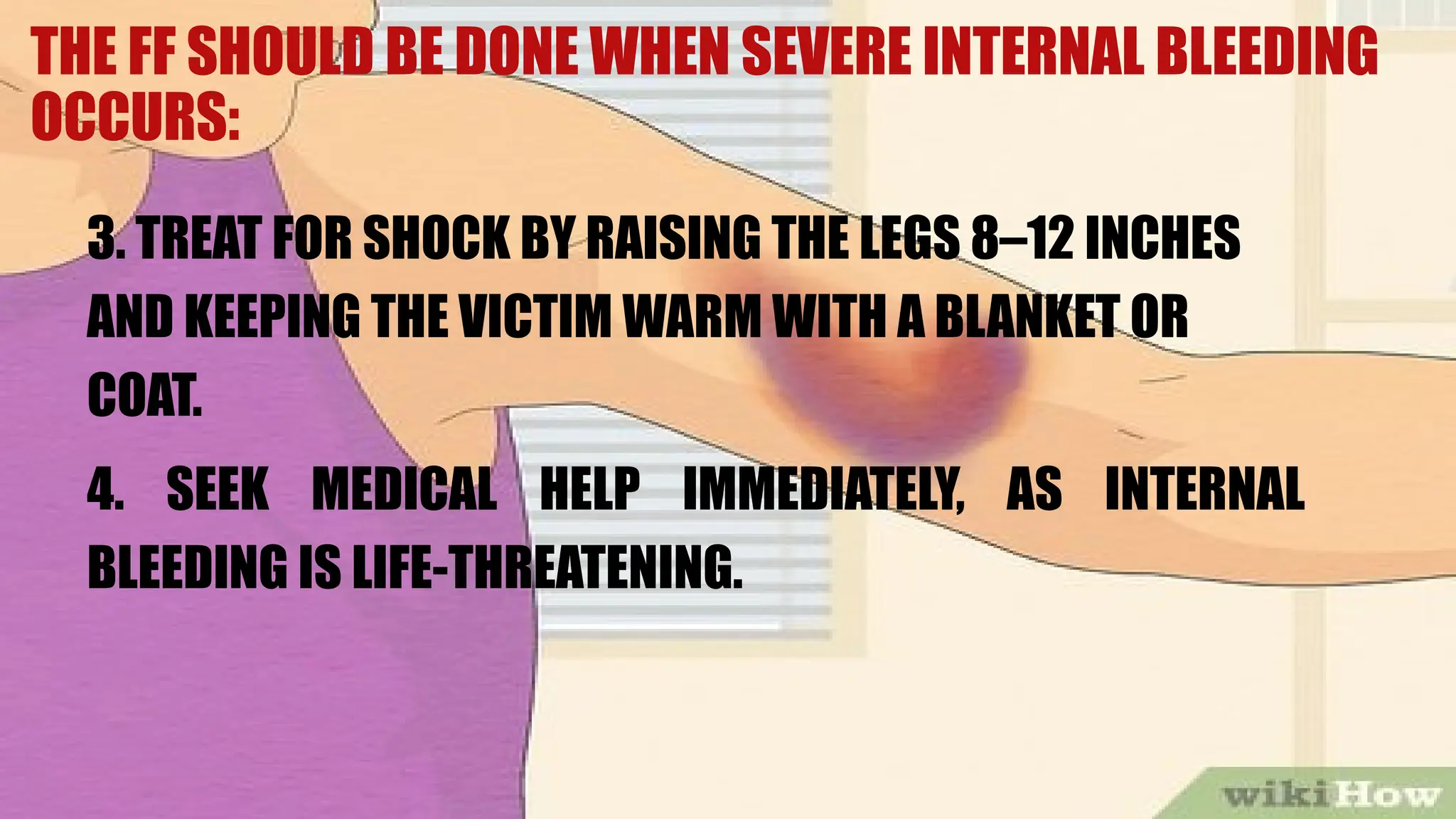 3. TREAT FOR SHOCK BY RAISING THE LEGS 8–12 INCHES
AND KEEPING THE VICTIM WARM WITH A BLANKET OR
COAT.
4. SEEK MEDICAL HELP IMMEDIATELY, AS INTERNAL
BLEEDING IS LIFE-THREATENING.
THE FF SHOULD BE DONE WHEN SEVERE INTERNAL BLEEDING
OCCURS:
 